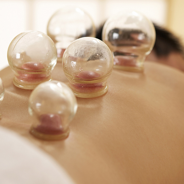 Cupping Therapy
