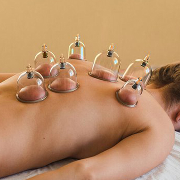 Hijama Therapy