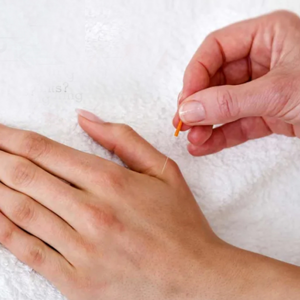 Sujok Therapy Treatment